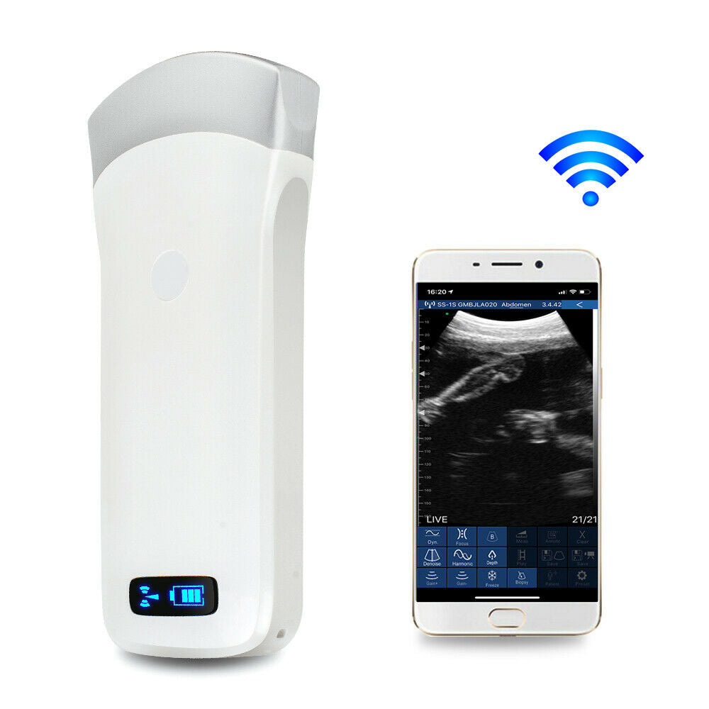 DigtalPortable WIFI Wireless Ultrasound Scanner Machine+3.5Mhz ConvexArray Probe DIAGNOSTIC ULTRASOUND MACHINES FOR SALE
