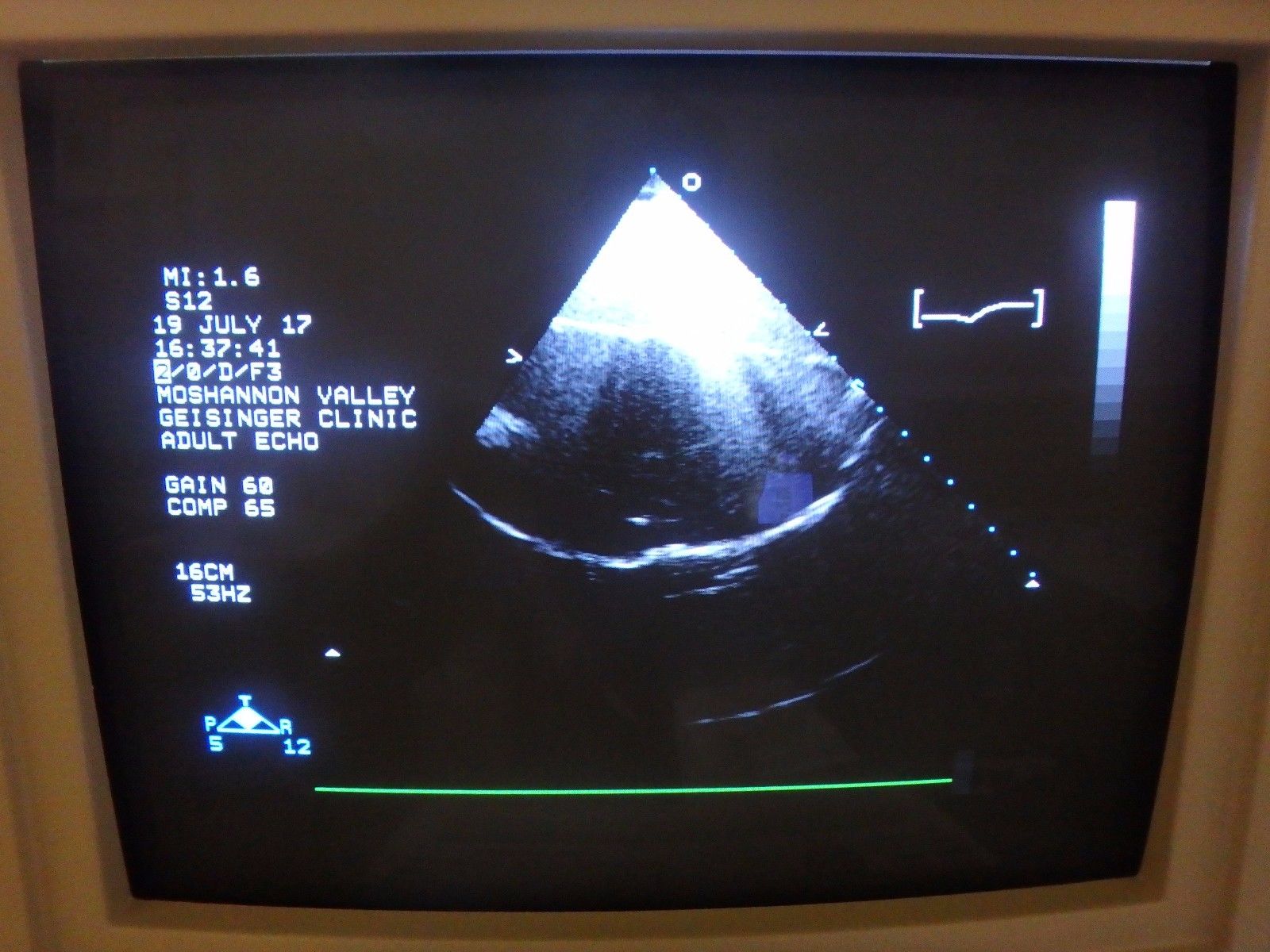 ultrasound monitor