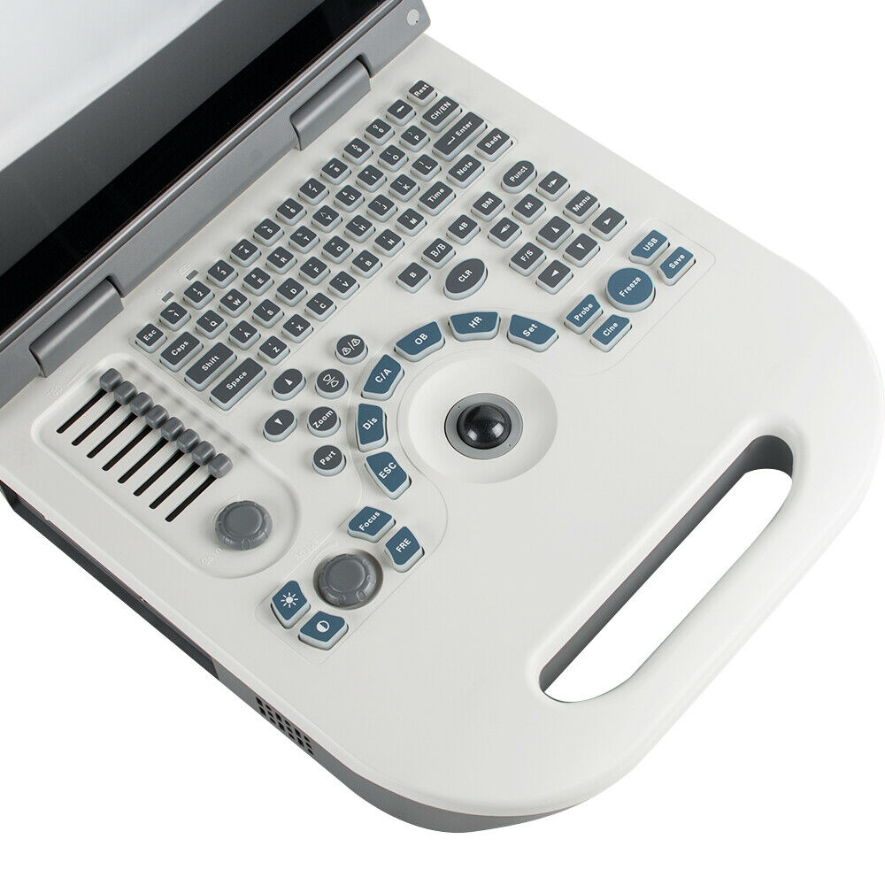 Portable Ultrasound Scanner Laptop Machine Safty Ultrasonic System+Convex Probe DIAGNOSTIC ULTRASOUND MACHINES FOR SALE