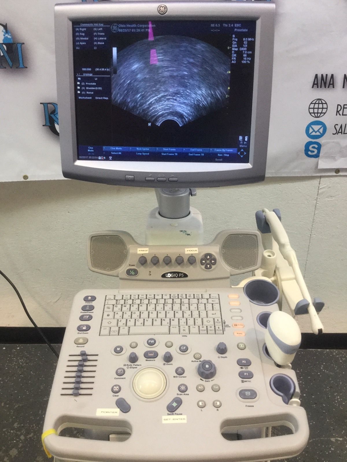 GE LOGIQ P5 2013 Ultrasound + Convex Volumetric Probe, endocavity Transducer DIAGNOSTIC ULTRASOUND MACHINES FOR SALE