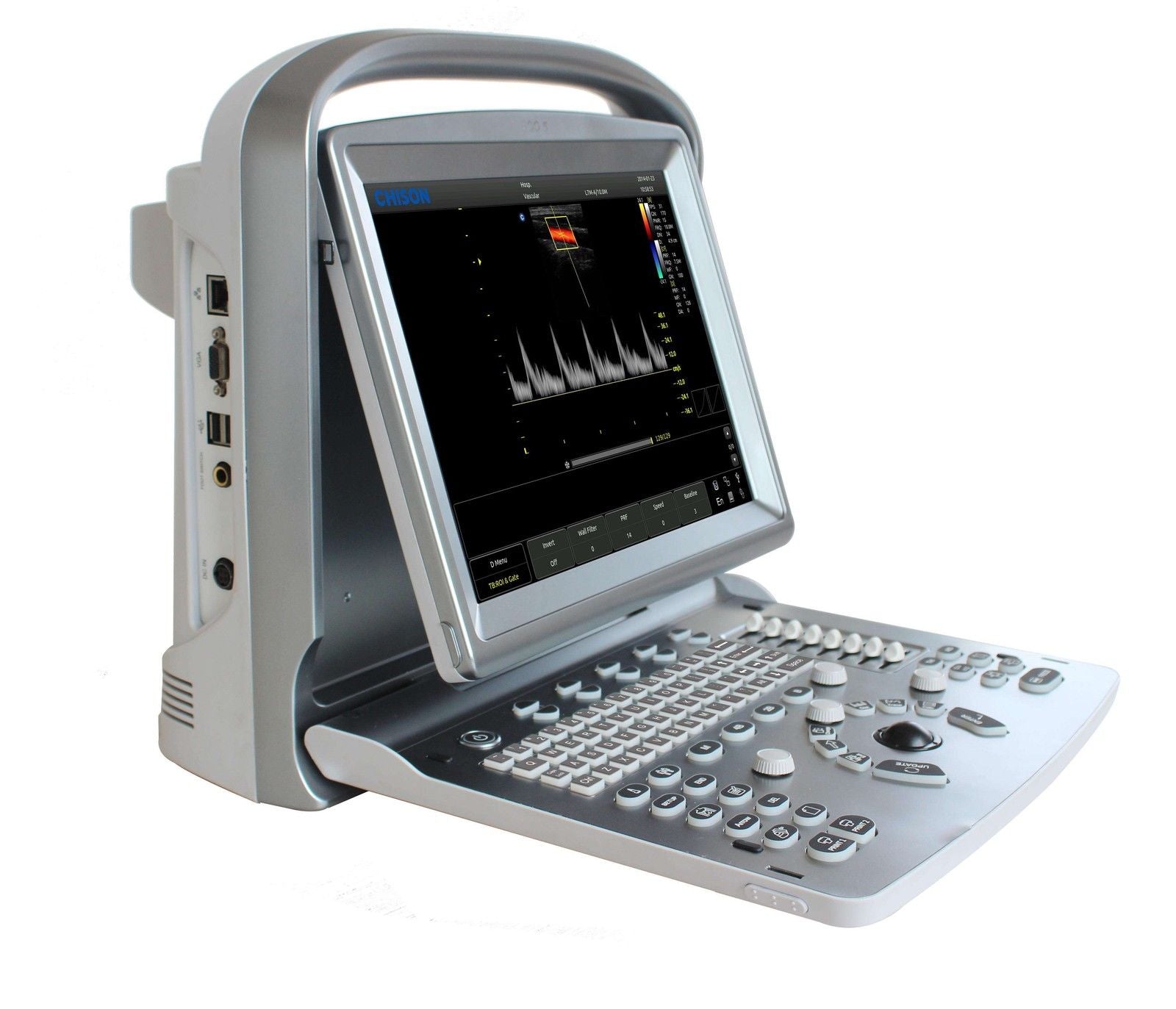 Chison ECO5 Ultrasound System *NEW* DIAGNOSTIC ULTRASOUND MACHINES FOR SALE