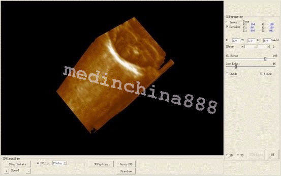 Man-Pack CCU Use Ultrasound Scanner Convex +Linear 2 Probes 3D Clear Image TOP 190891255112 DIAGNOSTIC ULTRASOUND MACHINES FOR SALE