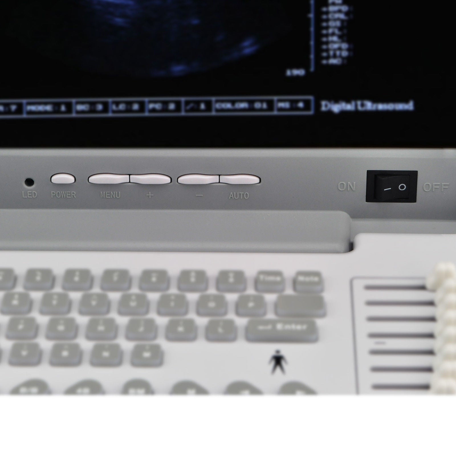 Portable 12'' SVGA LCD Digital Ultrasound Scanner System Convex Linear Probes 3D 190891802217 DIAGNOSTIC ULTRASOUND MACHINES FOR SALE