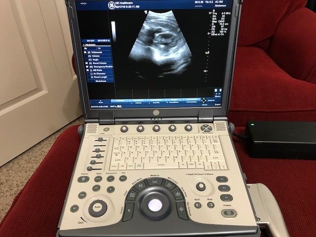 GE Logiq-E portable Ultrasound machine, MN 5148751 w/ 2 Probes and case DIAGNOSTIC ULTRASOUND MACHINES FOR SALE