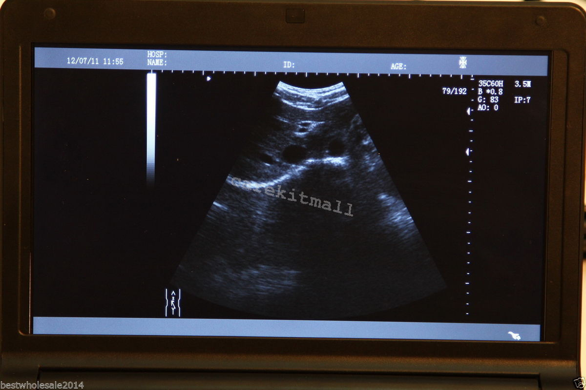 Portable Laptop Digital LCD Testor Ultrasound scanner with Transvaginal Probe CE 190891495471 DIAGNOSTIC ULTRASOUND MACHINES FOR SALE