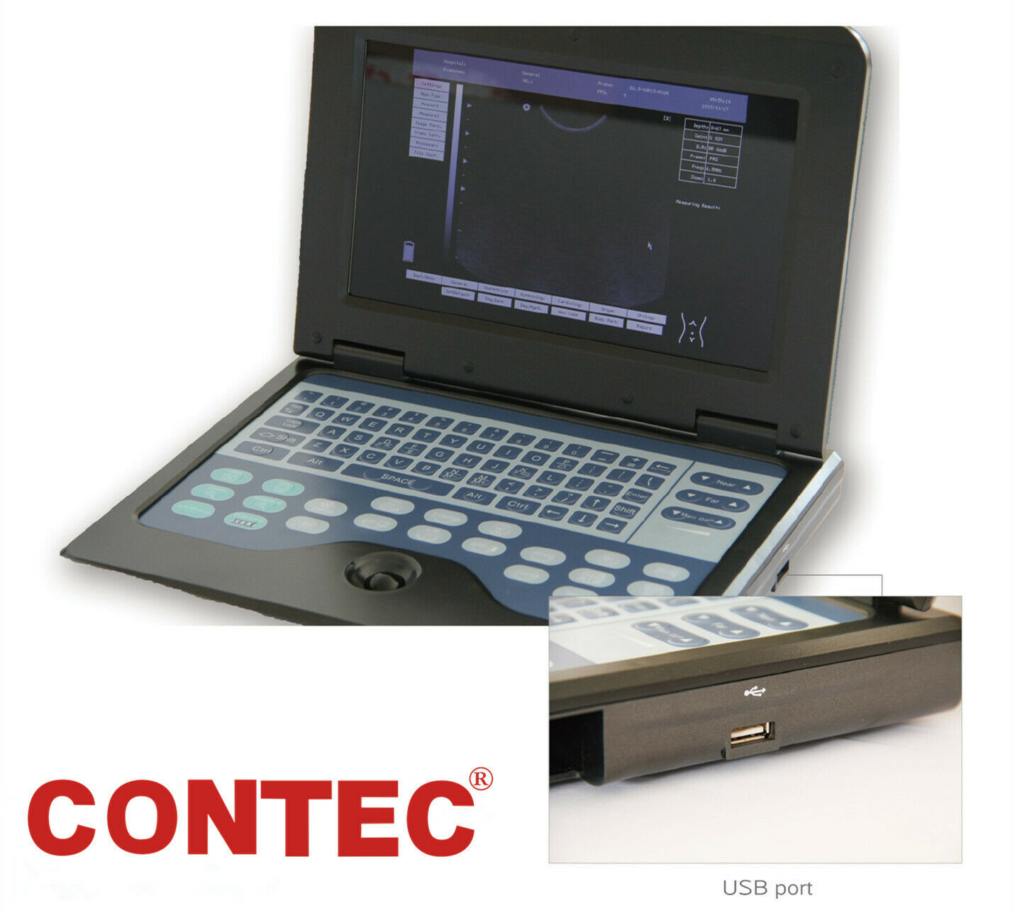 Digital B-Ultrasound Scanner Portable Machine +Convex Abdominal Ultrasound Probe DIAGNOSTIC ULTRASOUND MACHINES FOR SALE