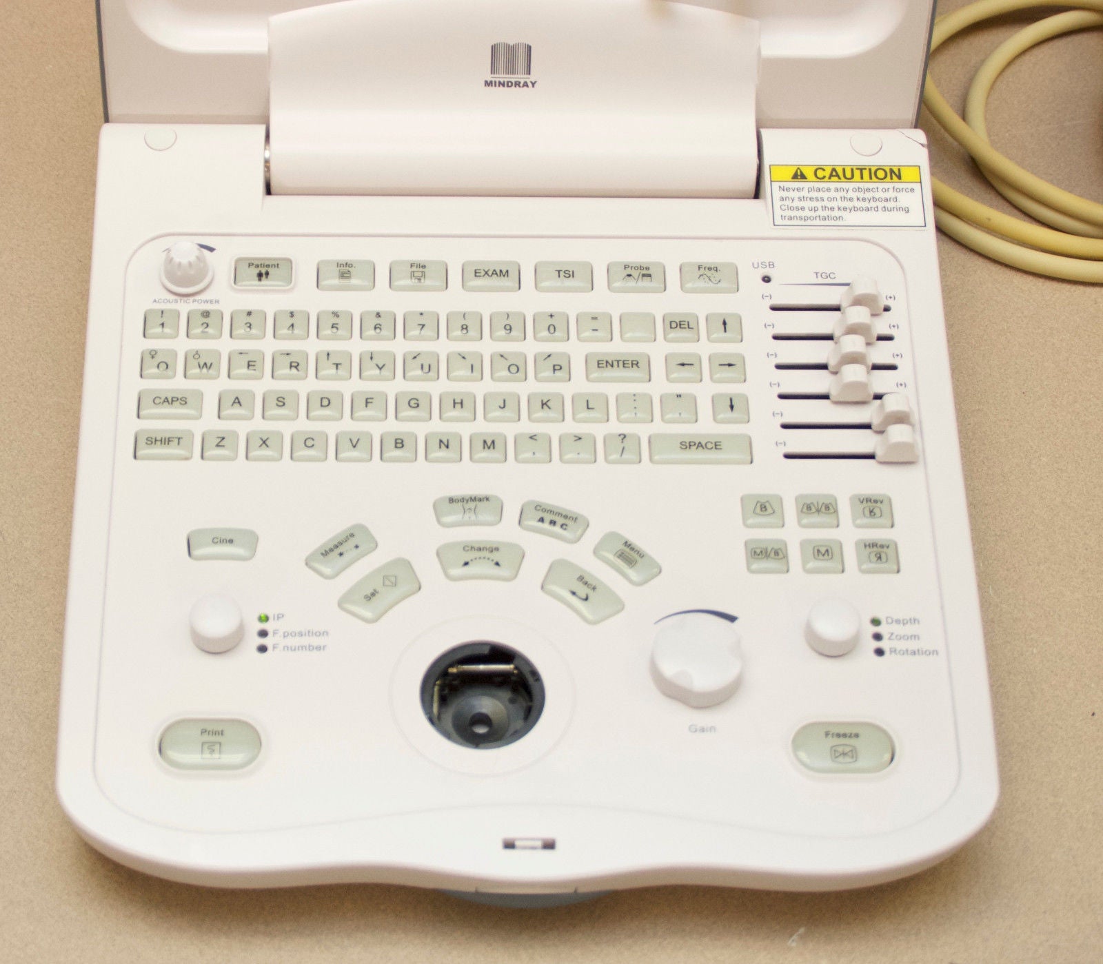 Shenzen Mindray DigiPrince DP-6600 Portable Ultrasound  (R15) DIAGNOSTIC ULTRASOUND MACHINES FOR SALE