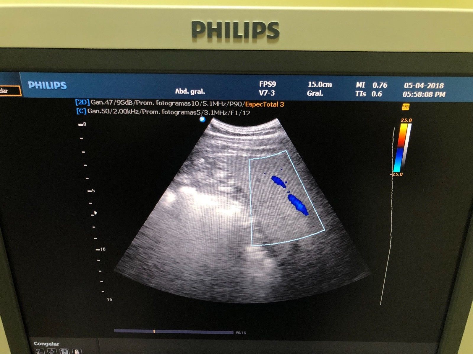 PHILIPS V7-3 4D CONVEX PROBE FOR HD9 DIAGNOSTIC ULTRASOUND MACHINES FOR SALE