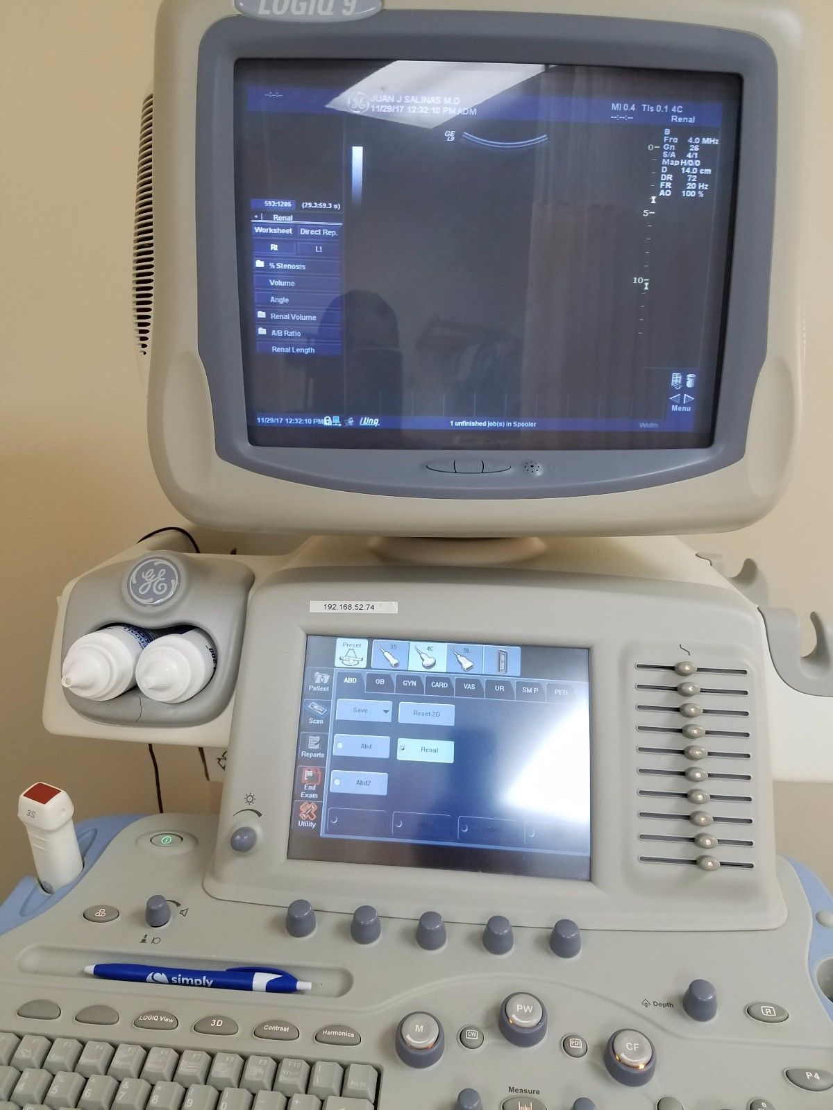 ultrasound GE Logiq 9 share services.  DIAGNOSTIC ULTRASOUND MACHINES FOR SALE