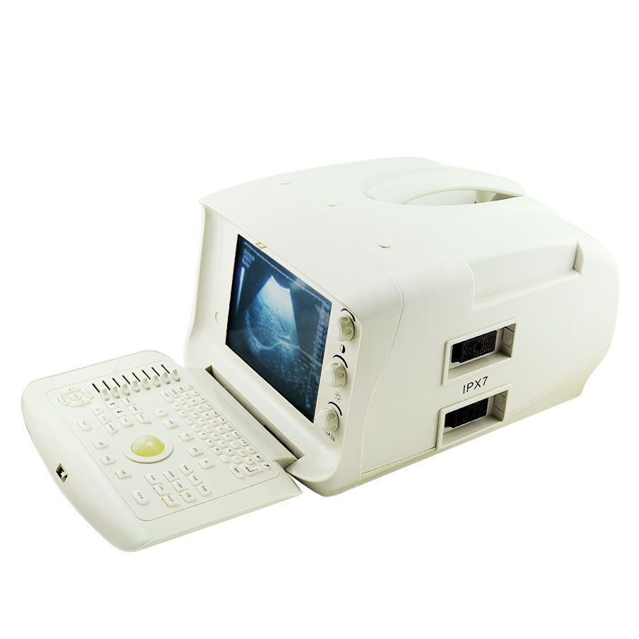 2 Probes Full Digital Ultrasound Machine Scanner Transvaginal+ Linear Probe AAA DIAGNOSTIC ULTRASOUND MACHINES FOR SALE