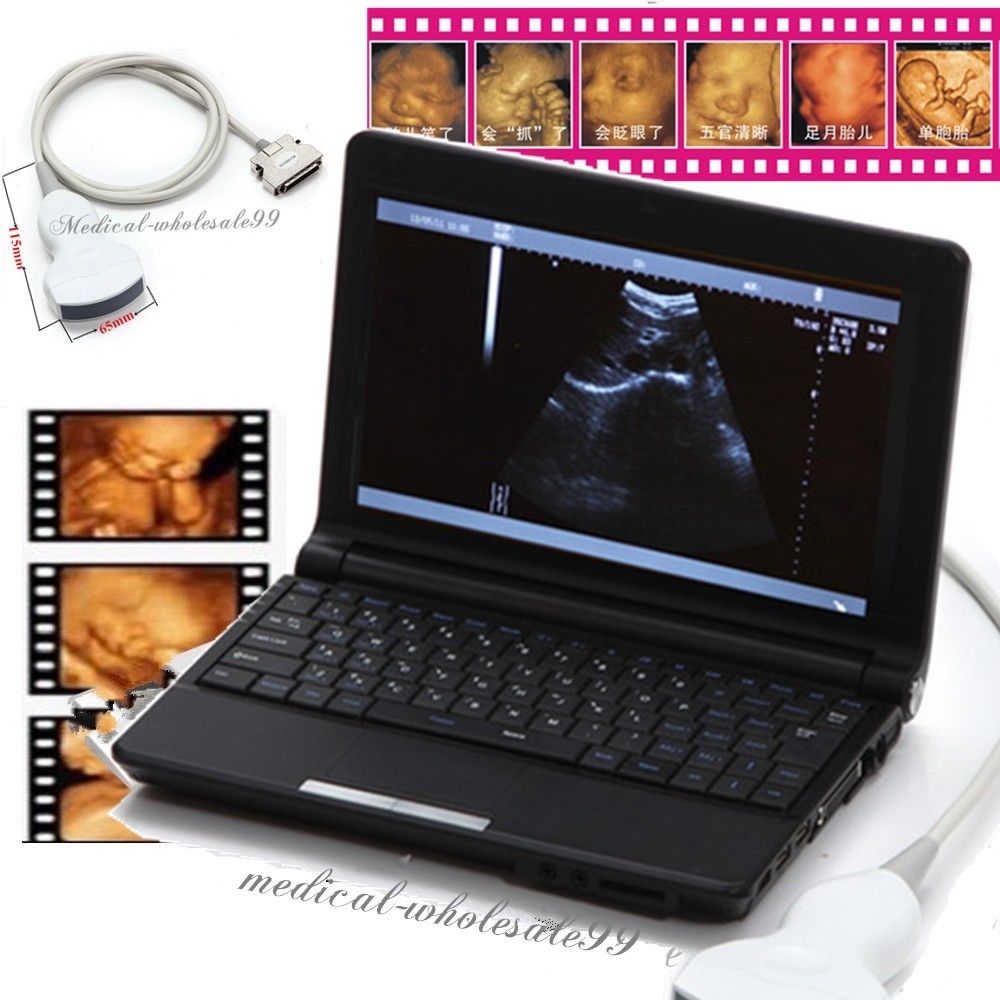 Laptop Ultrasound Scanner/Machine with Convex And Linear and Transvaginal  Probe DIAGNOSTIC ULTRASOUND MACHINES FOR SALE