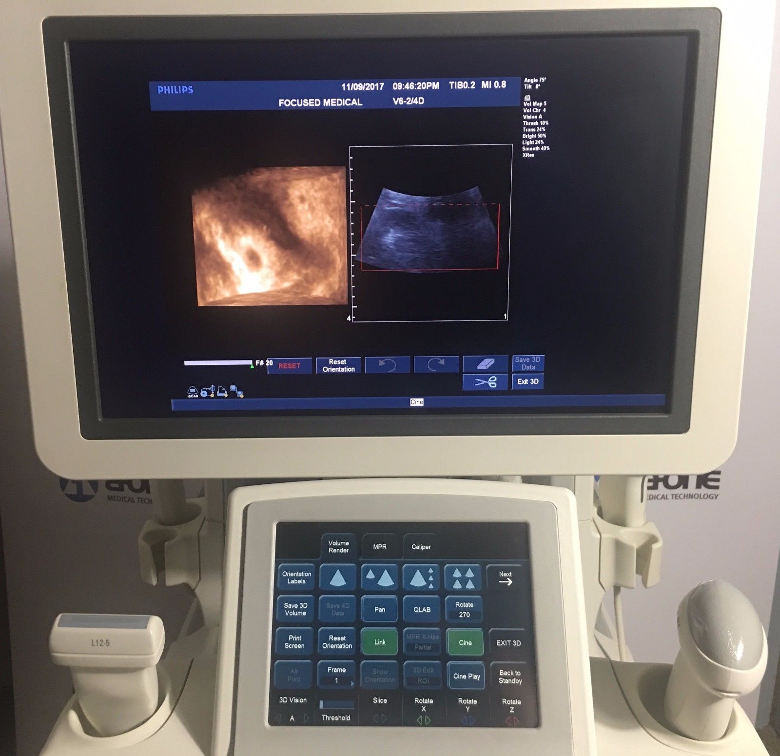 Philips IU22 3D/4D Ultrasound System with 4 Probes Cart#E  "Excellent Condition"