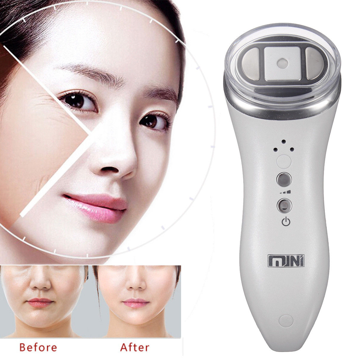 Intensity Focused Ultrasound Ultrasonic HIFU/RF LED Facial Machine Salon Beauty  6034327932229 DIAGNOSTIC ULTRASOUND MACHINES FOR SALE