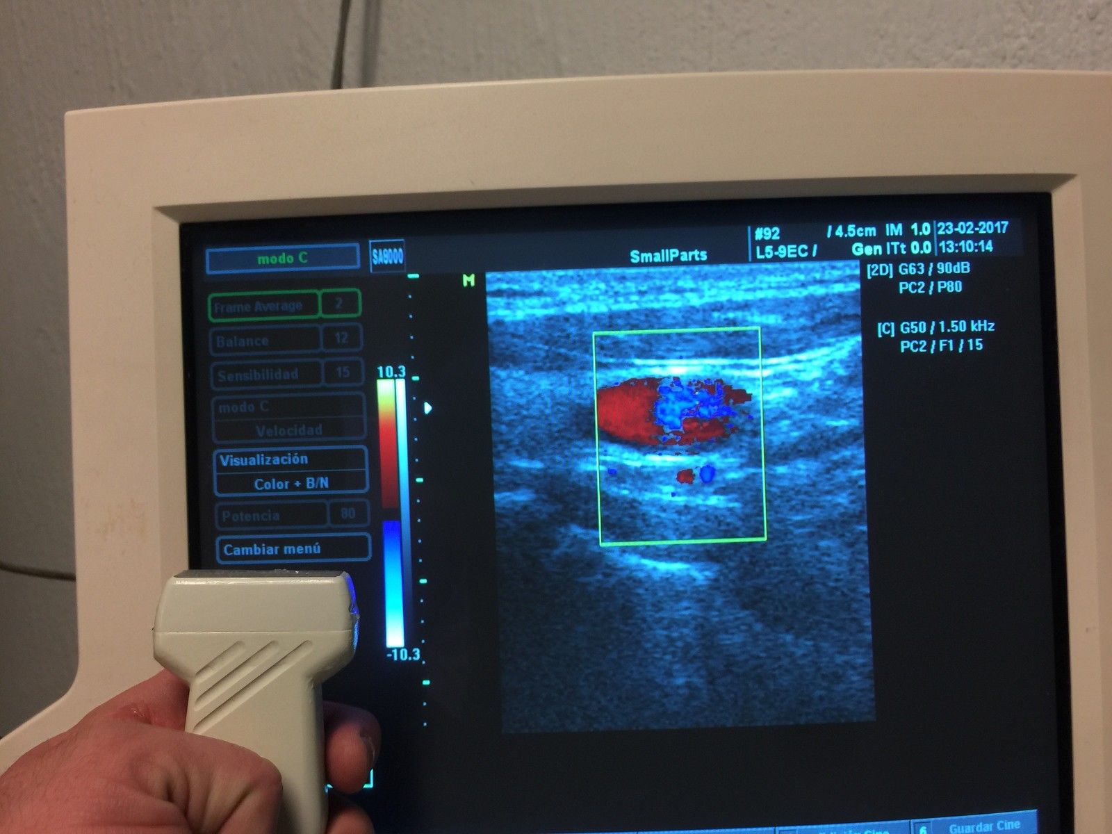MEDISON L5-9 7.5 MHz Linear Probe FOR SA5500/6000/8800/8000SE/8000EX/8000LV/PICO DIAGNOSTIC ULTRASOUND MACHINES FOR SALE