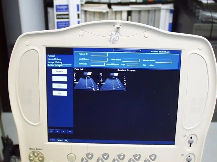 GE LogiqBook XP Porable Ultrasound with 3 transducers & Cart DIAGNOSTIC ULTRASOUND MACHINES FOR SALE