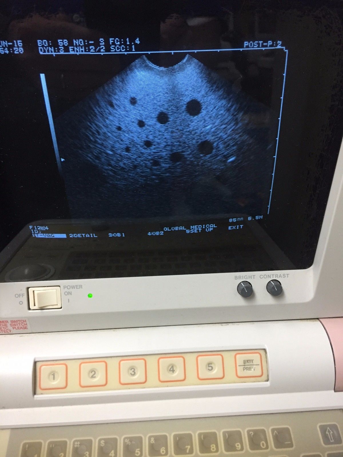 Hitachi EUP-V33 intercavity Ultrasound Probe / Has some dropout. DIAGNOSTIC ULTRASOUND MACHINES FOR SALE