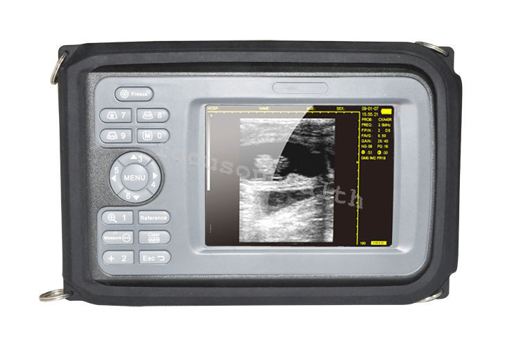 Vet Portable 64Cases Digital Ultrasound Scanner Monitor with Rectal Probe USA DIAGNOSTIC ULTRASOUND MACHINES FOR SALE