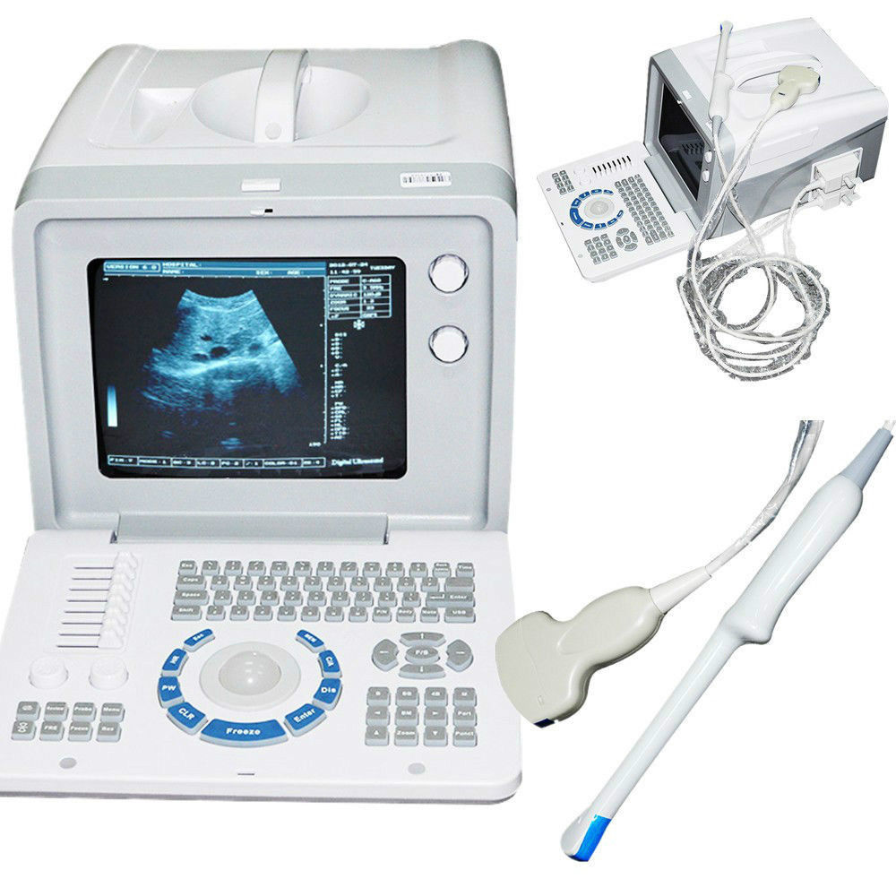 Portable Laptop Ultrasound Scanner Machine Convex +Transvaginal Probe+ 3D, DHL 190891047663 DIAGNOSTIC ULTRASOUND MACHINES FOR SALE