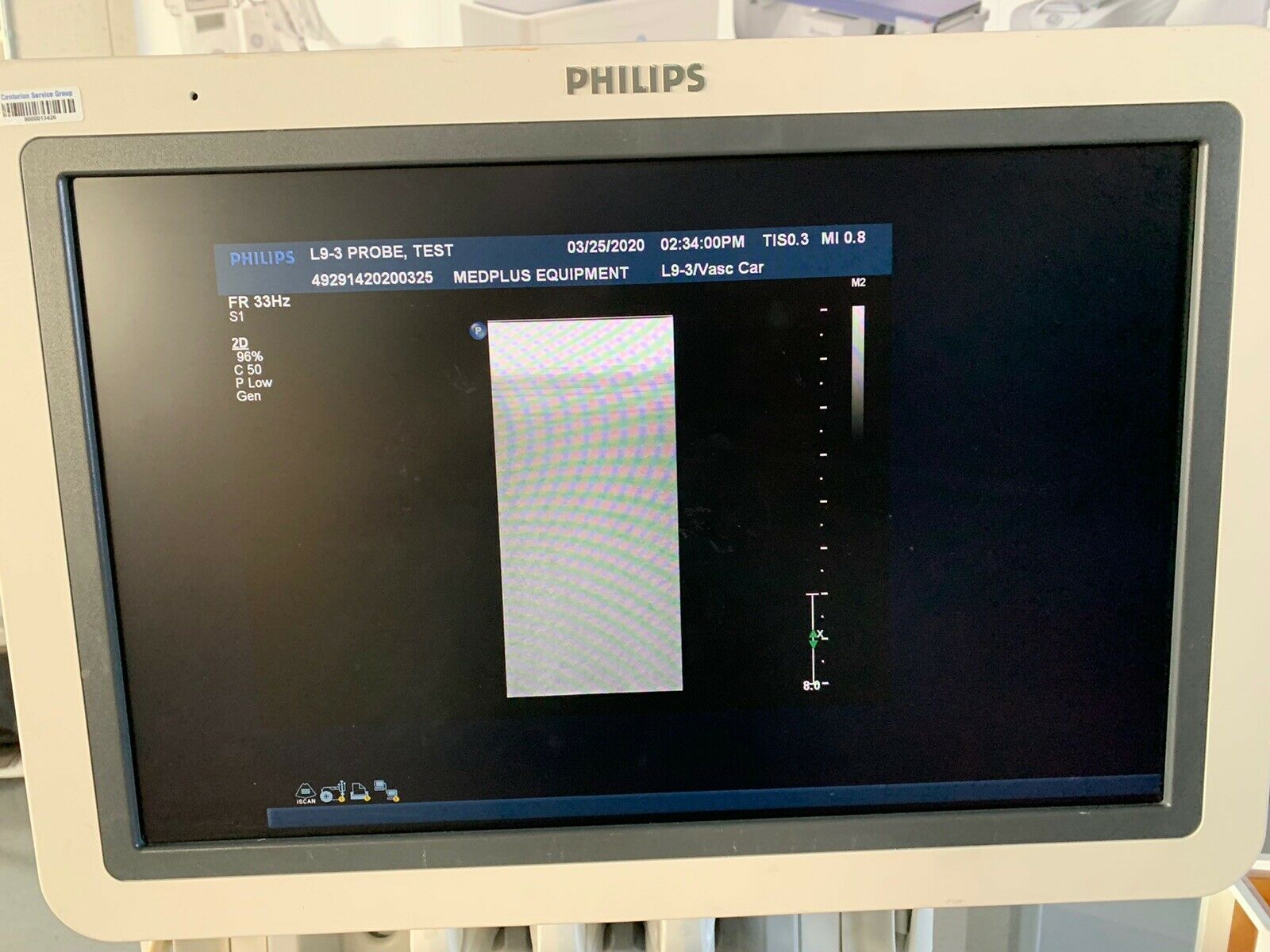 PHILIPS ULTRASOUND TRANSDUCER L9-3 PROBE, REMOVED FROM PHILIPS IU22 DIAGNOSTIC ULTRASOUND MACHINES FOR SALE