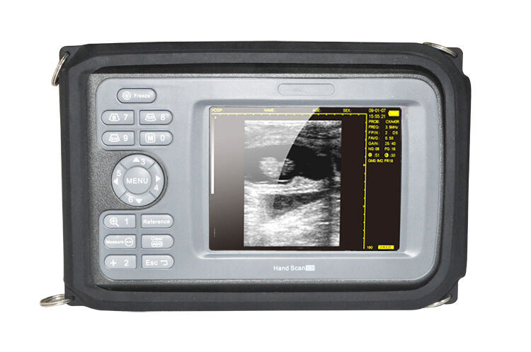 Portable Veterinary Digital Ultrasound Scanner Machine For Animal+Rectal Probe DIAGNOSTIC ULTRASOUND MACHINES FOR SALE