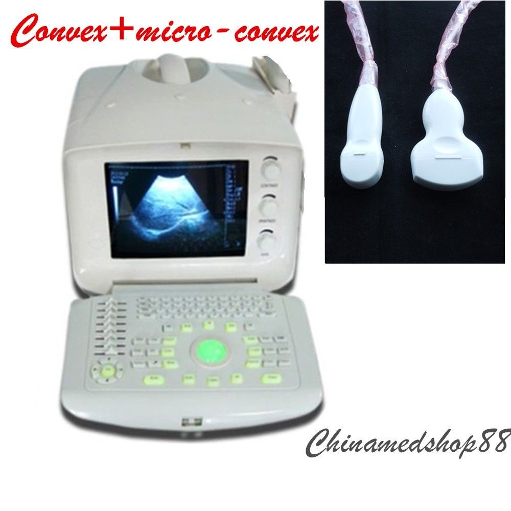 Digital Ultrasound Scanner Machine+Convex +Micro-convex 2 Probes + Oximeter Sale DIAGNOSTIC ULTRASOUND MACHINES FOR SALE