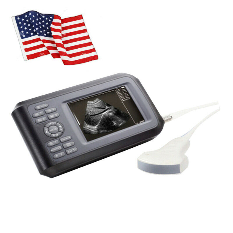 Handheld Portable Ultrasound Machine Scanner Convex Porbe/Sensor For Human Use DIAGNOSTIC ULTRASOUND MACHINES FOR SALE