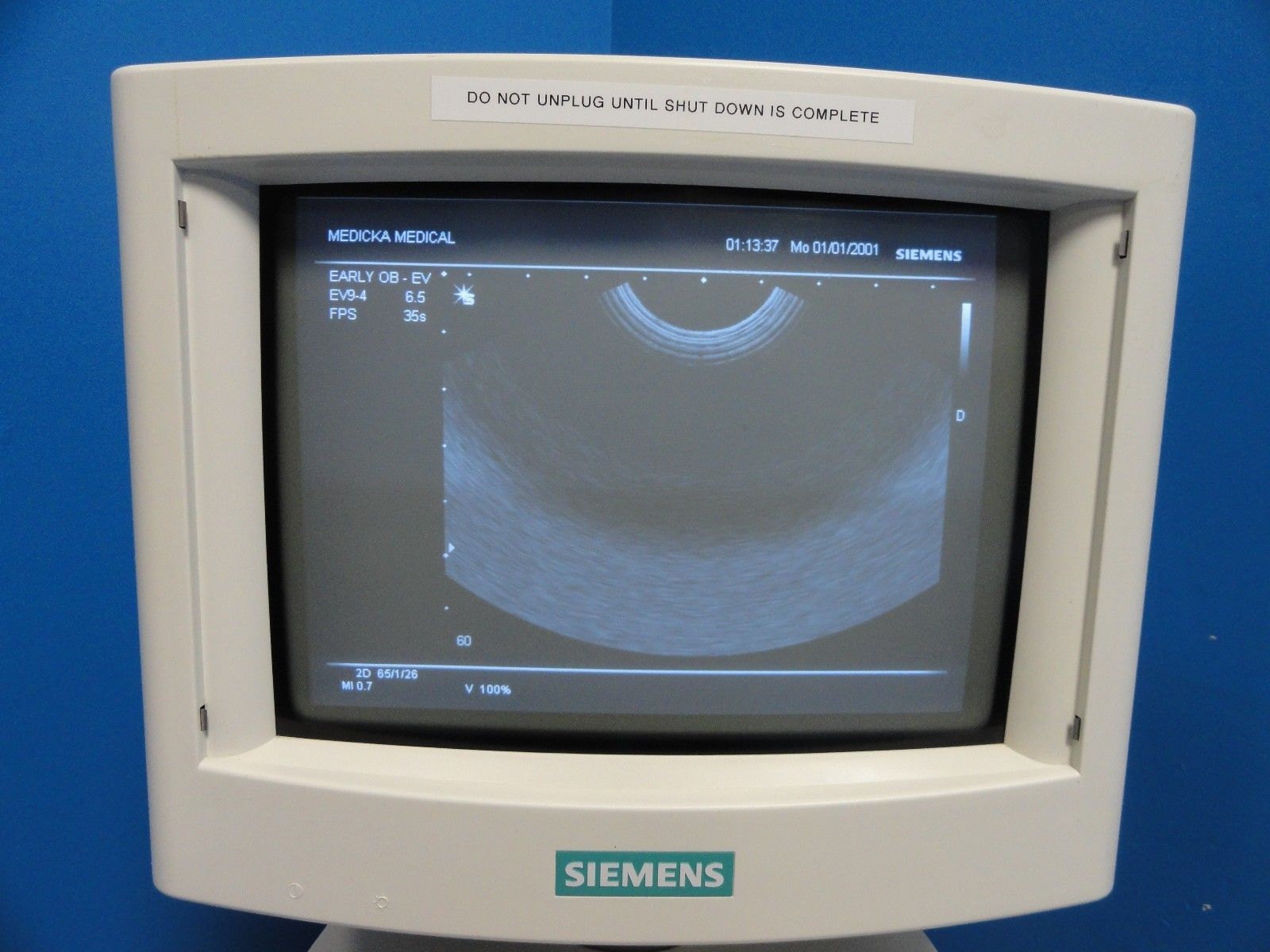 2004 Siemens Sonoline G20 Ultrasound W/ C5-2 & EV9-4 Probes Printer & UPS(10964) DIAGNOSTIC ULTRASOUND MACHINES FOR SALE