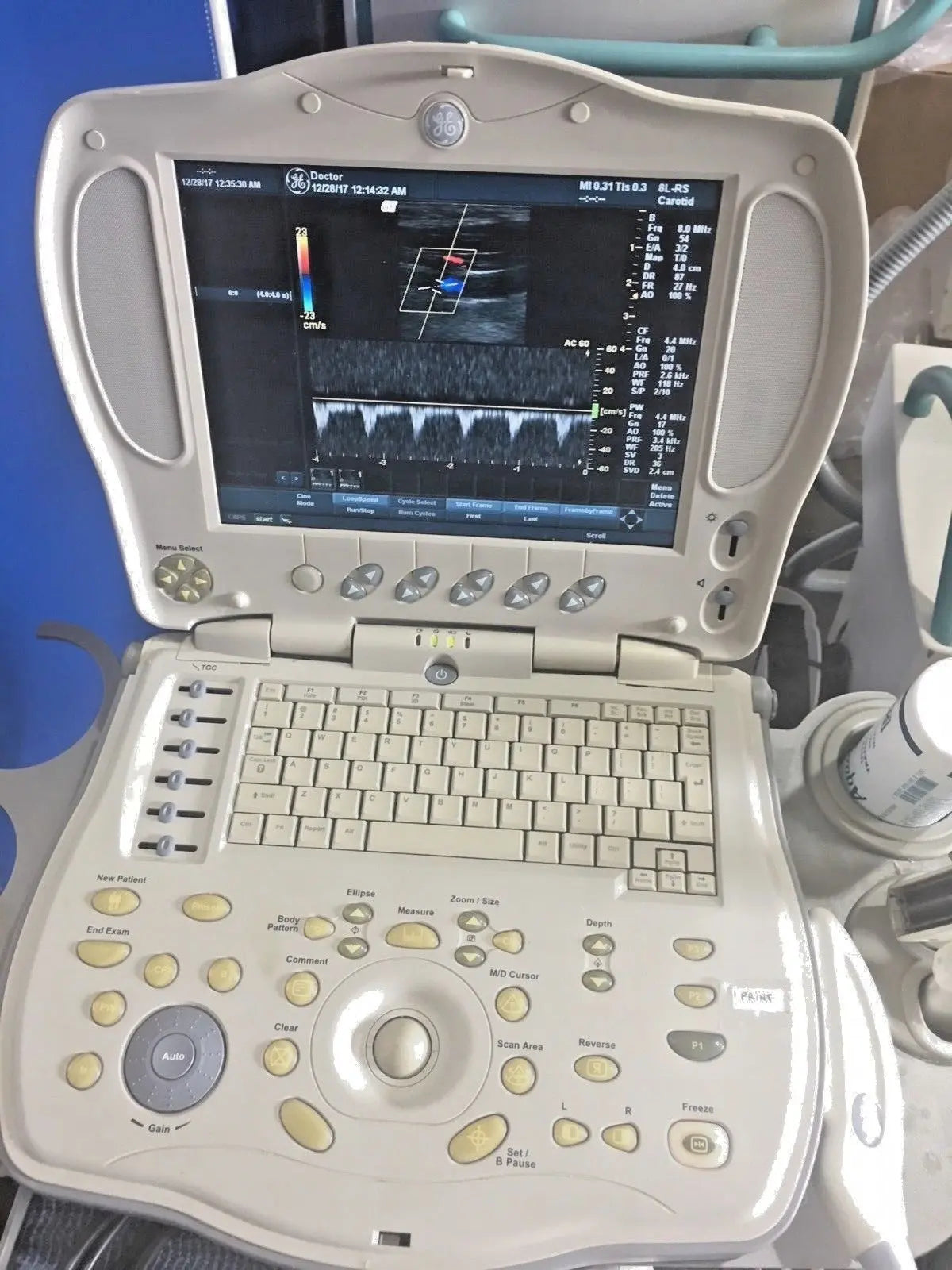 GE LogiqBook XP Porable Ultrasound with 3 transducers & Cart DIAGNOSTIC ULTRASOUND MACHINES FOR SALE