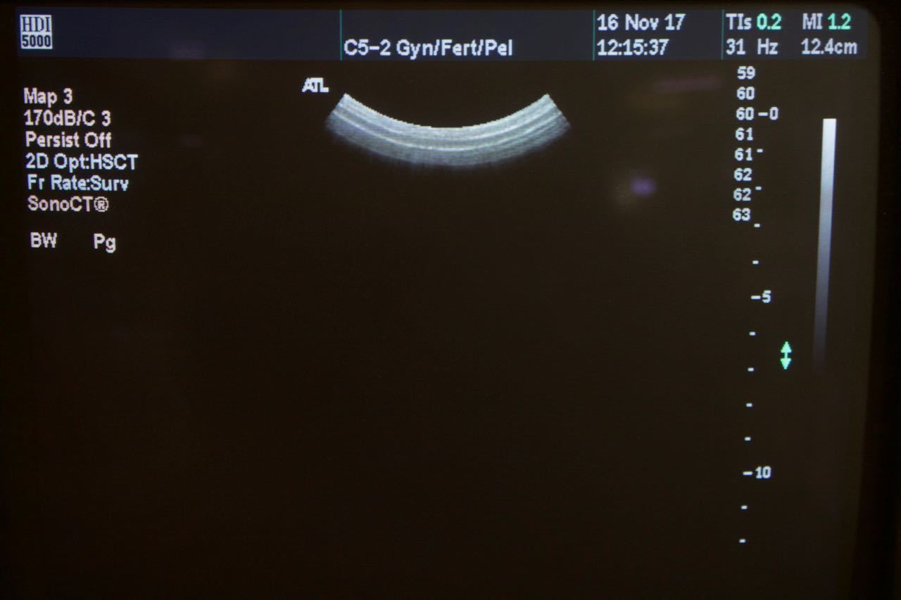 Philips ATL C5-2 40R Curved Array Ultrasound Transducer HDI5000 4000-0574-05 DIAGNOSTIC ULTRASOUND MACHINES FOR SALE