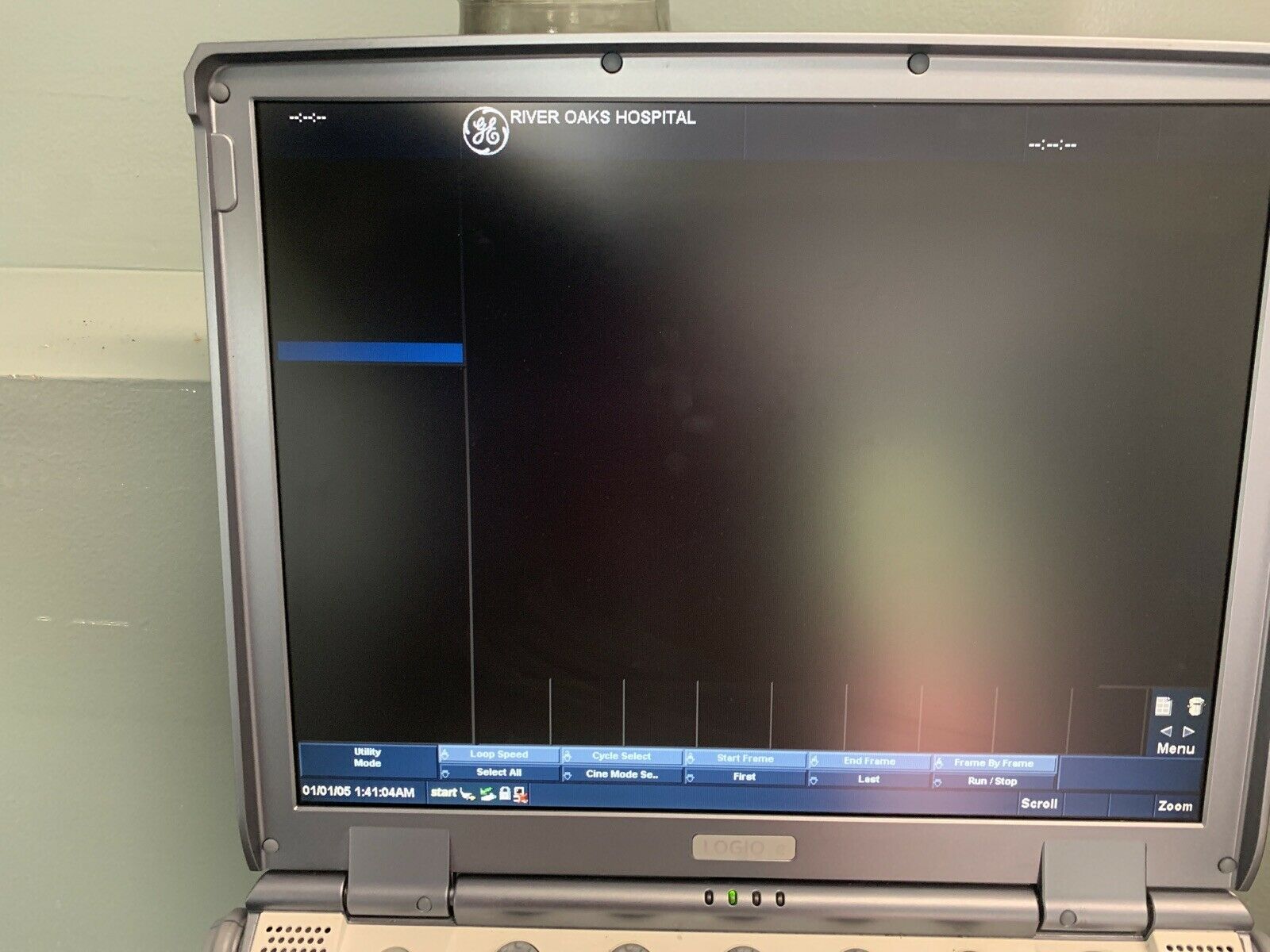 GE Logiq E Ultrasound 2007 DIAGNOSTIC ULTRASOUND MACHINES FOR SALE