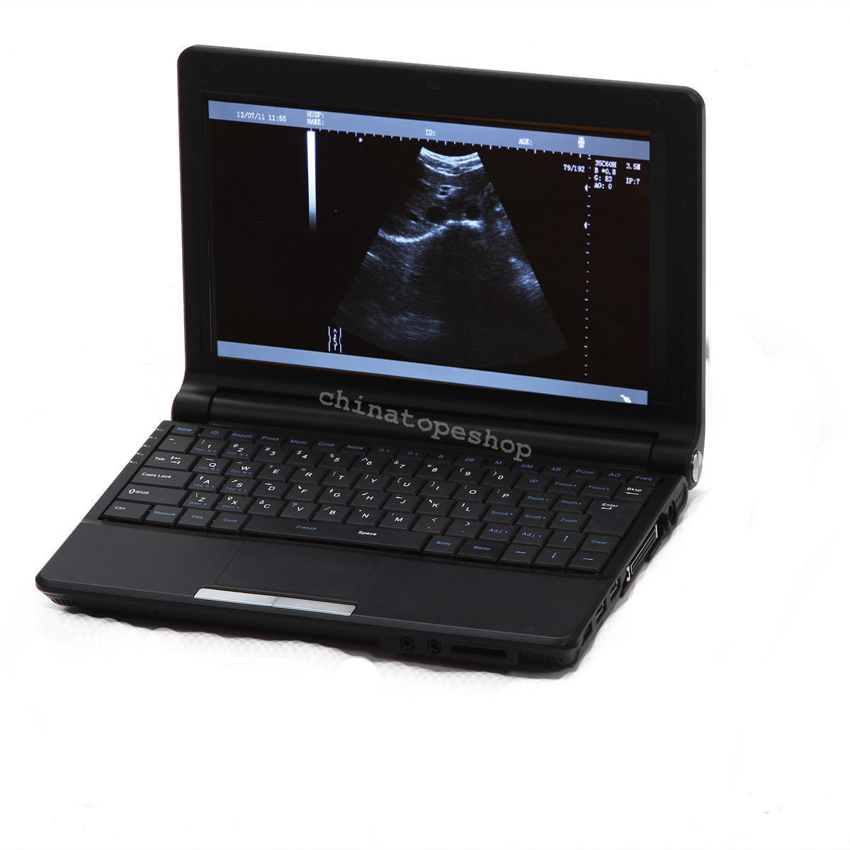 Digital Laptop Notebook ultrasound scanner machine Convex  Linear 2 probes 3D 190891559289 DIAGNOSTIC ULTRASOUND MACHINES FOR SALE