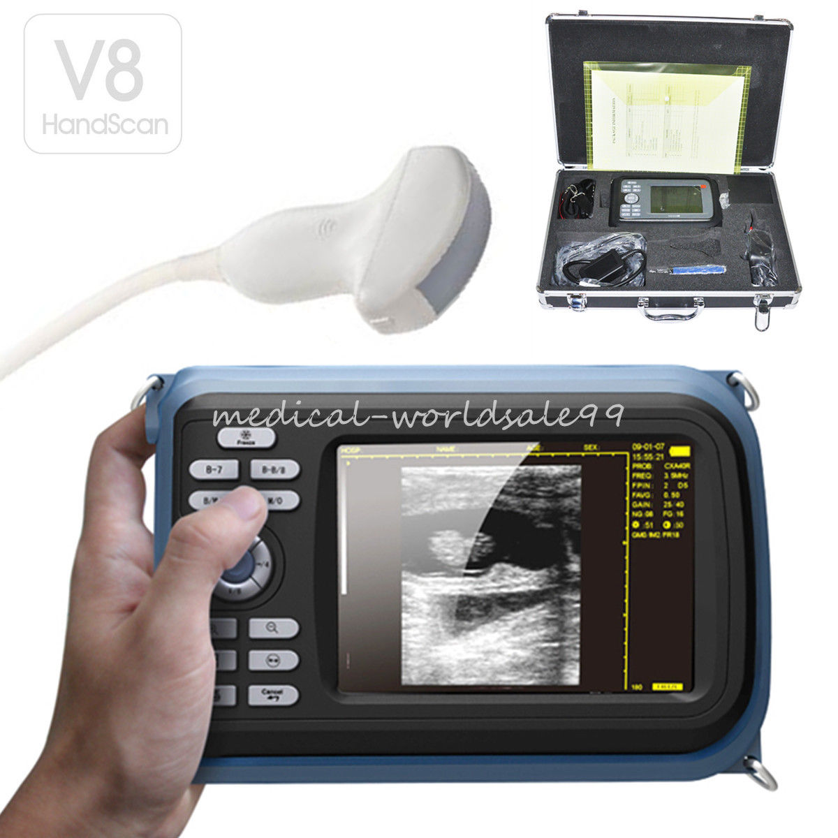 Handheld Palmtop Machine Ultrasound Scanner Cardiac Micro-Convex Probe Sale CE 190891436733 DIAGNOSTIC ULTRASOUND MACHINES FOR SALE