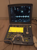 GE Voluson-e portable ultrasound System