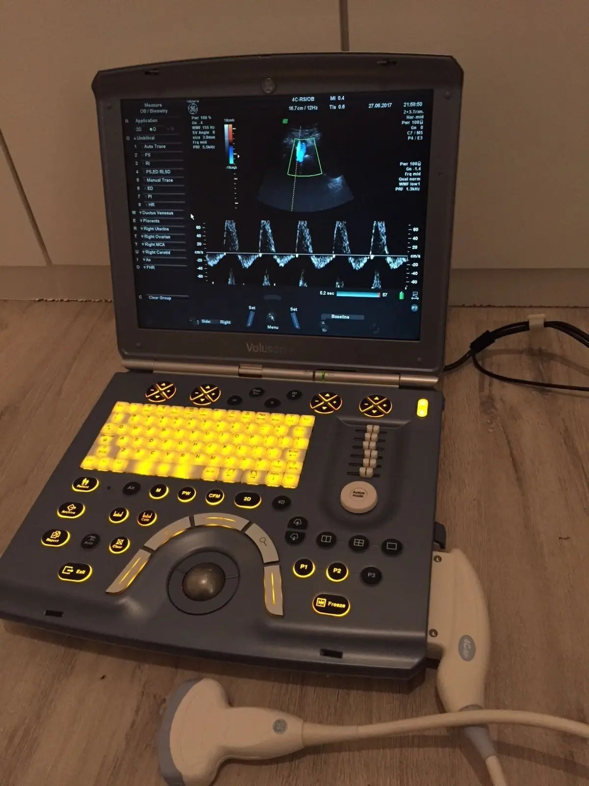 GE Voluson-e portable ultrasound System DIAGNOSTIC ULTRASOUND MACHINES FOR SALE