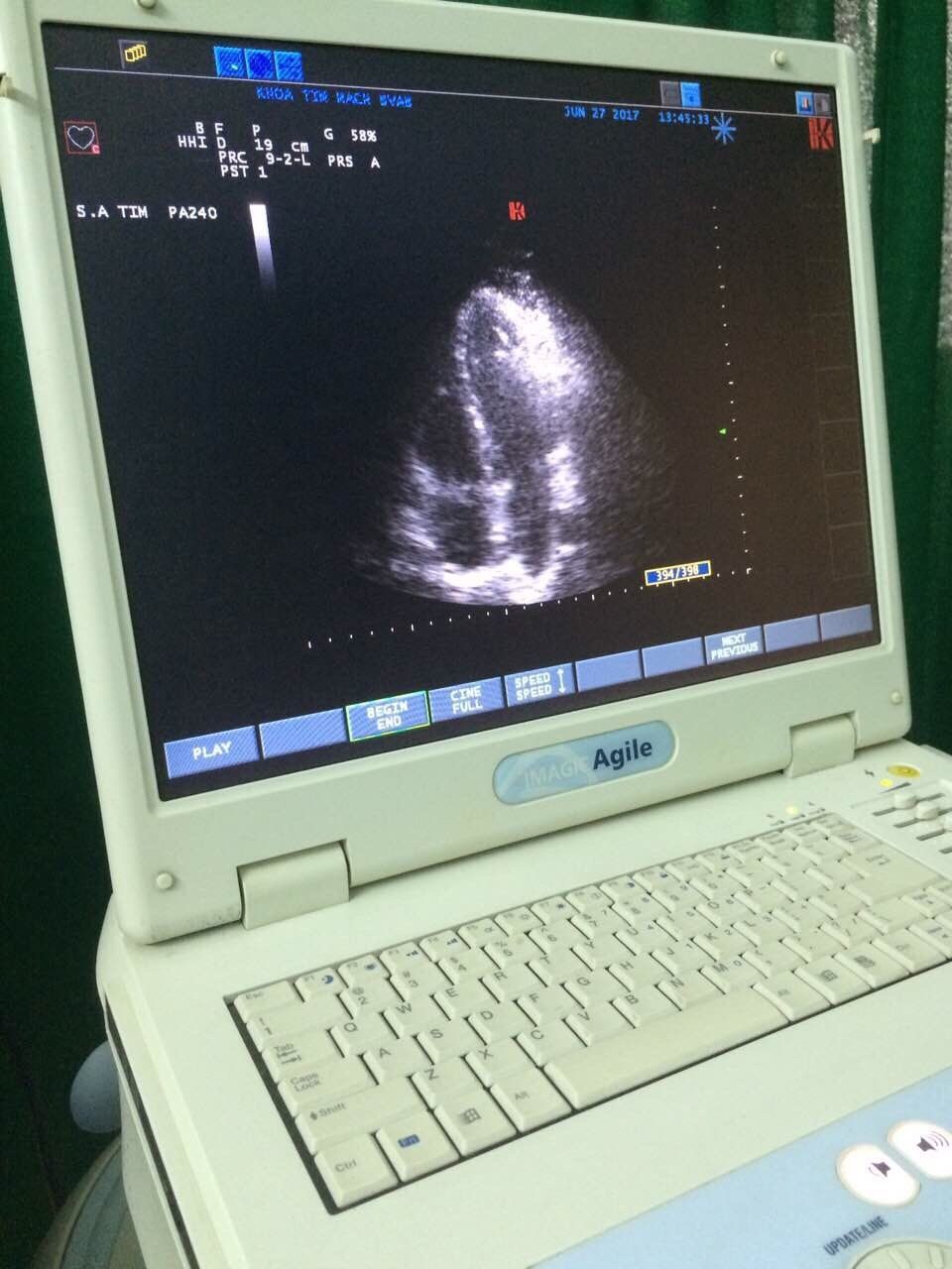 Esaote Biosound Megas/ MyLab ultrasound PA240 Phase Array probe DIAGNOSTIC ULTRASOUND MACHINES FOR SALE