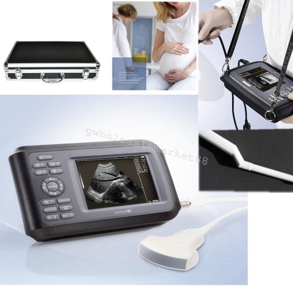 HandScan Full Digital Ultrasound scanner Machine Convex+ Transvaginal probe Case DIAGNOSTIC ULTRASOUND MACHINES FOR SALE