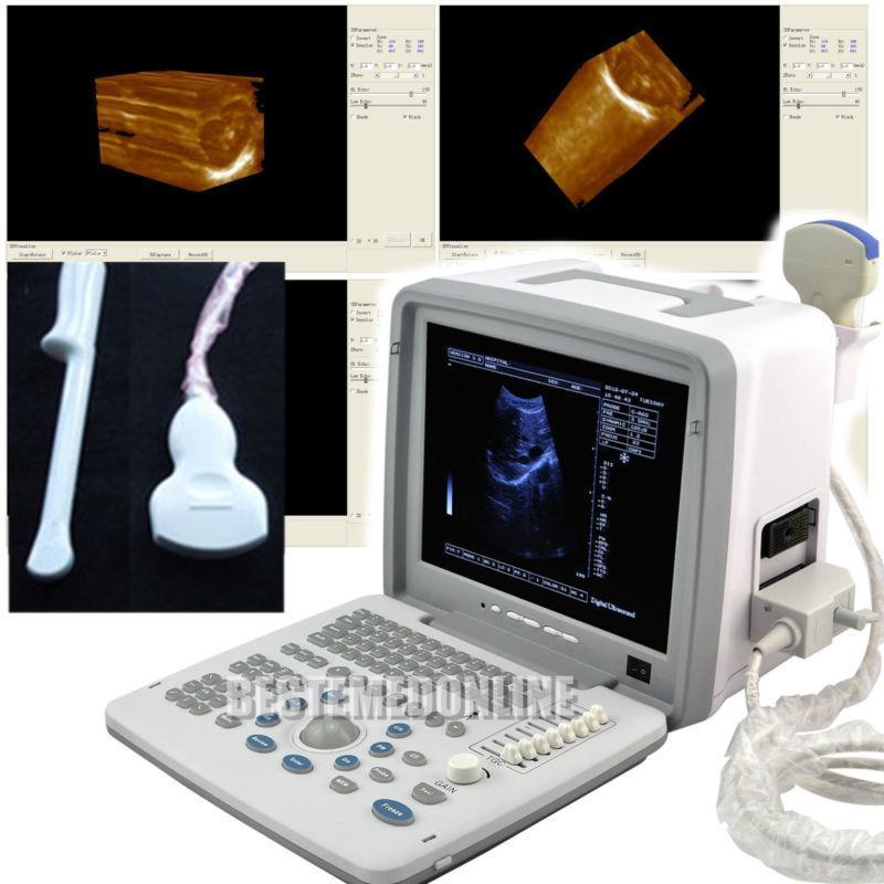 Full Digital Ultrasound Scanner Machine With Convex Transvaginal Probe +3D Image 190891911506 DIAGNOSTIC ULTRASOUND MACHINES FOR SALE
