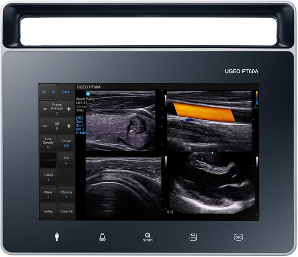 Samsung PT60A Tablet-Style Portable Ultrasound (DEMO) DIAGNOSTIC ULTRASOUND MACHINES FOR SALE