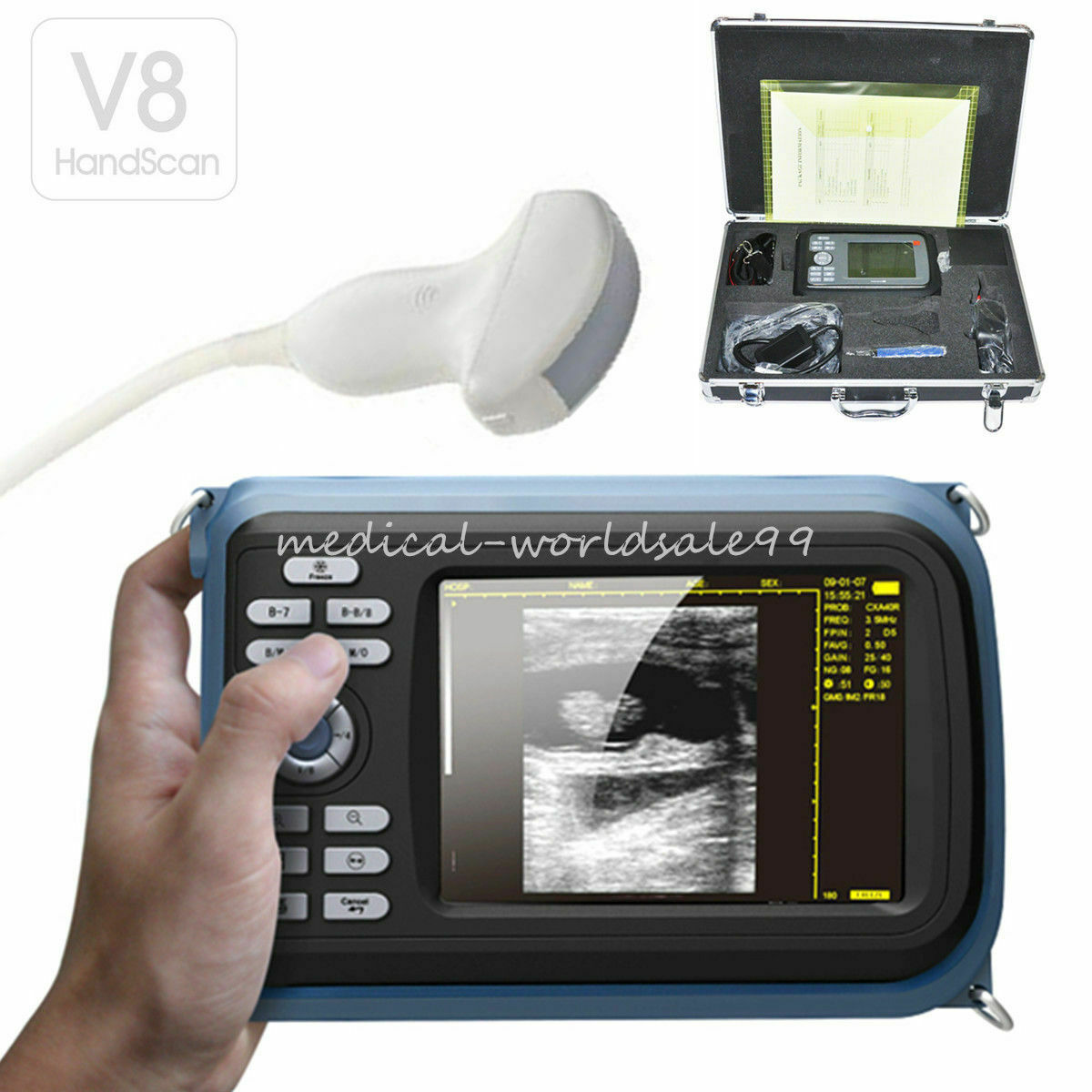 Digital LCD Ultrasound Scanner Machine Human Use With R40 3.5Mhz Convex Probe DIAGNOSTIC ULTRASOUND MACHINES FOR SALE