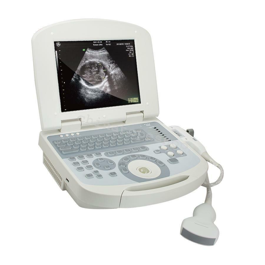 Notebook/Laptop Digital Ultrasound Scanner Convex/Abdominal Probe US STOCK DIAGNOSTIC ULTRASOUND MACHINES FOR SALE