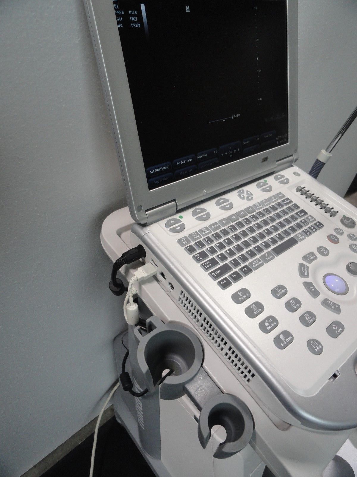 Mindray M7 Portable Ultrasound Loaded unit with 3 probes transducers no sonosite DIAGNOSTIC ULTRASOUND MACHINES FOR SALE