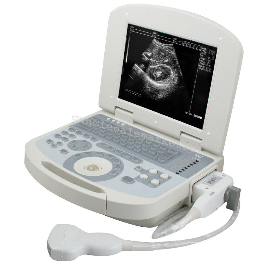 Portable Ultrasound Machine Scanner System Convex probe 3D Software Best Image 190891045898 DIAGNOSTIC ULTRASOUND MACHINES FOR SALE