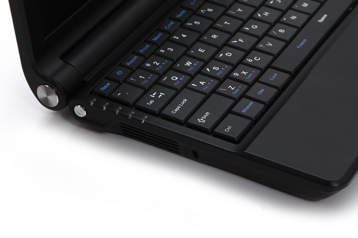 Laptop Ultrasonic Machine  Ultrasound Scanner Linear Vascular Probe + Oximeter 190891797605 DIAGNOSTIC ULTRASOUND MACHINES FOR SALE