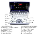 GE LOGIQ E  B11 ULTRASOUND UNIT YEAR 2012 / 4 RC-Rs Probe WOW MINT MINT