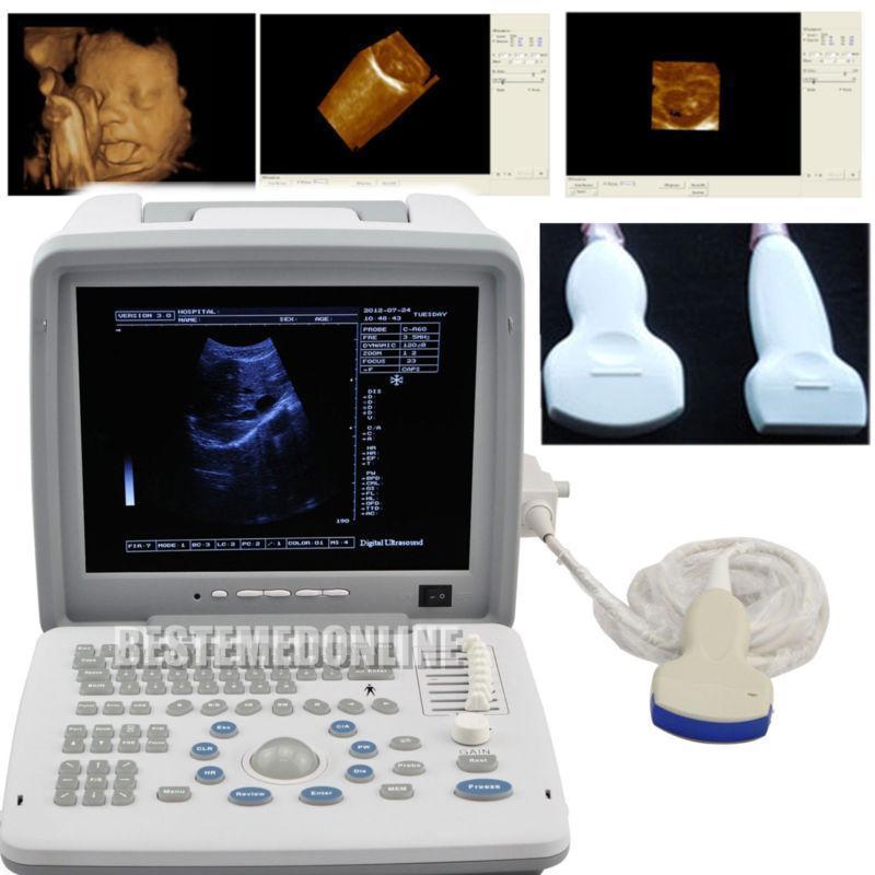 Portable Ultrasound Scanner System Convex  Linear 2 Probes  2 CONNECTORS 3D DIAGNOSTIC ULTRASOUND MACHINES FOR SALE