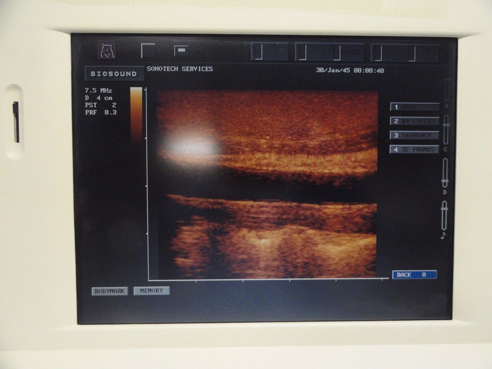 ESAOTE Biosound LA522E Linear Array Ultrasound Probe for MyLab Series ~12899 DIAGNOSTIC ULTRASOUND MACHINES FOR SALE