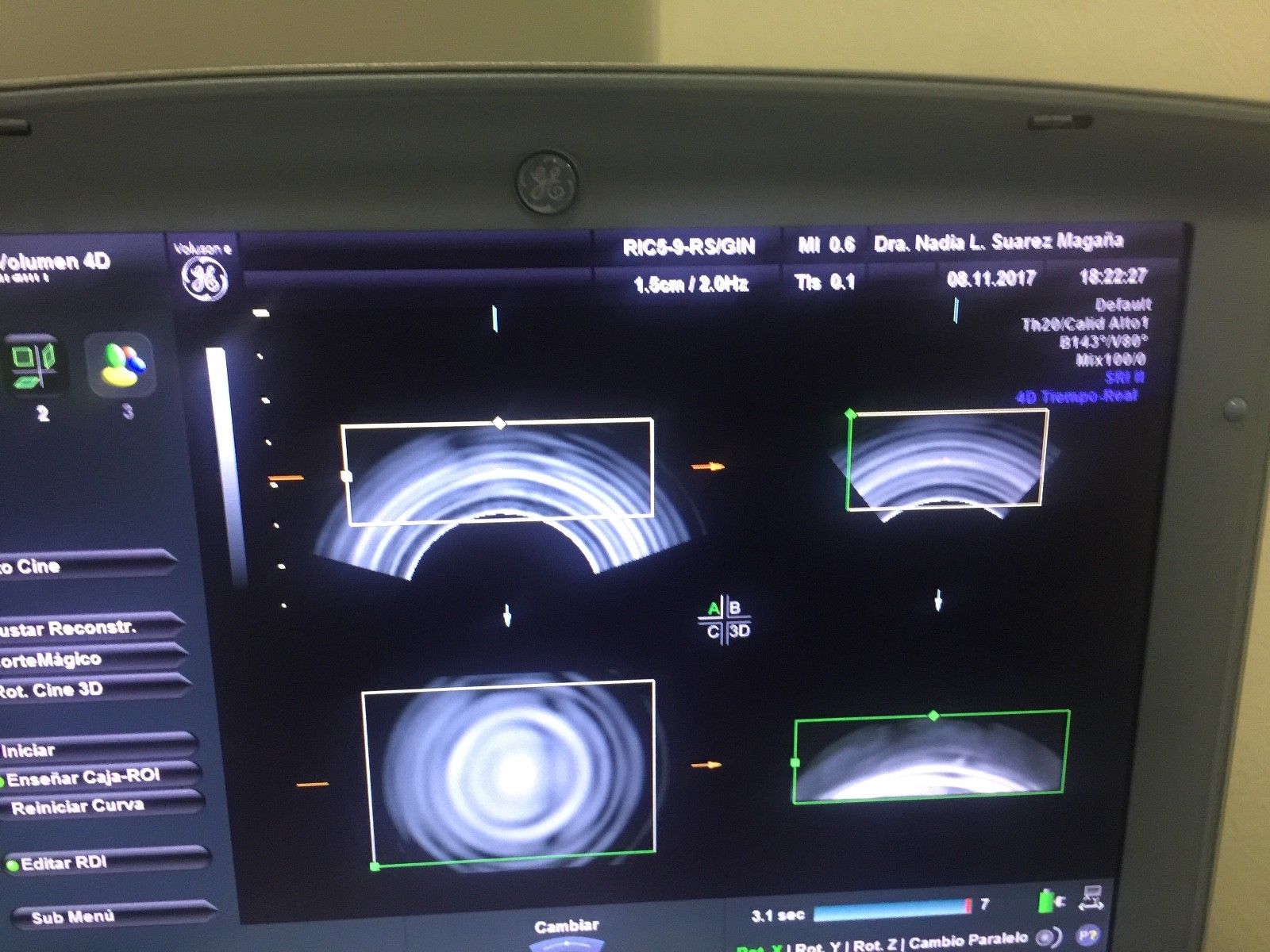 GE RIC5-9-RS 4D ENDOCAVITY PROBE FOR VOLUSON i/e DIAGNOSTIC ULTRASOUND MACHINES FOR SALE