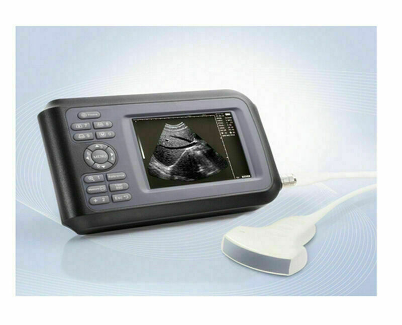 Handscan Ultrasound Scanner Machine Digital For Human Use 3.5Mhz Convex Probe US DIAGNOSTIC ULTRASOUND MACHINES FOR SALE