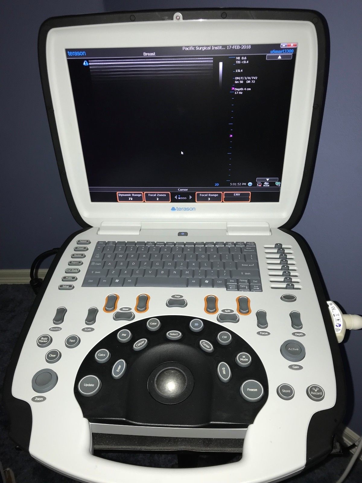 Terason USmart 3300 Ultrasound DIAGNOSTIC ULTRASOUND MACHINES FOR SALE