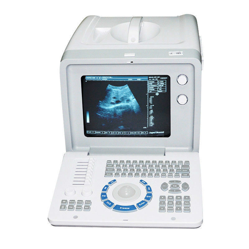 Portable Diagnostic Ultrasound Scanner Convex +Transvaginal 2 Probe 3D Pregnancy 190891054135 DIAGNOSTIC ULTRASOUND MACHINES FOR SALE